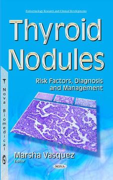 portada Thyroid Nodules (Endocrinology Research Clinica)