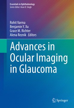 portada Advances in Ocular Imaging in Glaucoma (en Inglés)