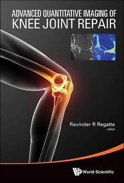 portada Advanced Quantitative Imaging of Knee Joint Repair