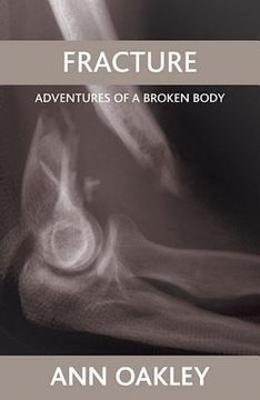 fracture,adventures of a broken body