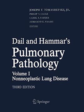 portada Dail and Hammar's Pulmonary Pathology: Volume I: Nonneoplastic Lung Disease (in English)