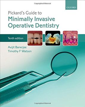 portada Pickard's Guide to Minimally Invasive Operative Dentistry (en Inglés)