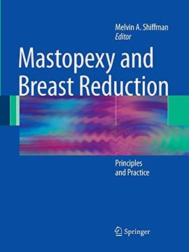 portada Mastopexy and Breast Reduction: Principles and Practice (in English)