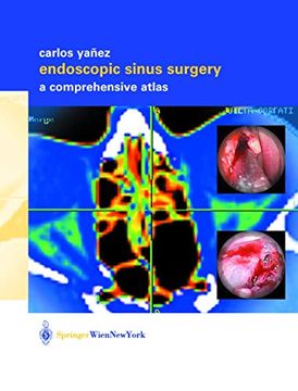 portada Endoscopic Sinus Surgery: A Comprehensive Atlas (en Inglés)