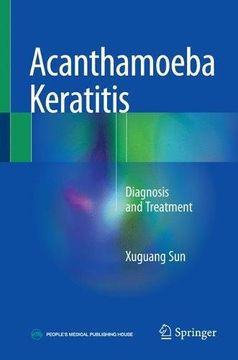 portada Acanthamoeba Keratitis: Diagnosis and Treatment (en Inglés)