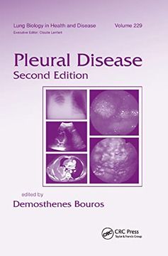 portada Pleural Disease (Lung Biology in Health and Disease) (en Inglés)