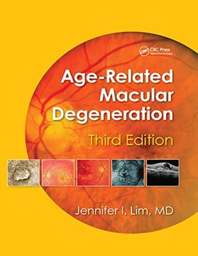 portada Age-Related Macular Degeneration, Third Edition (en Inglés)