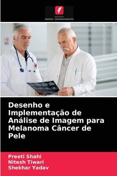 portada Desenho e Implementação de Análise de Imagem Para Melanoma Câncer de Pele (en Portugués)