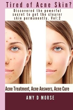 portada TIRED OF ACNE SKIN? Discover the Powerful Secrets to get Clearer Skin Permanently (en Inglés)