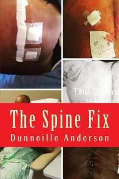 portada The Spine Fix: Life lessons on overcoming spinal surgery and improving your quality of life (en Inglés)