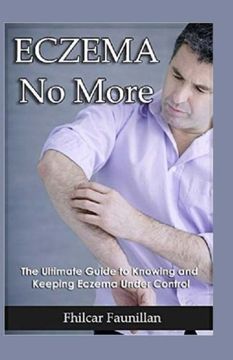 portada Eczema Cure: Eczema no More - the Ultimate Guide to Knowing and Keeping Eczema Under Control (en Inglés)
