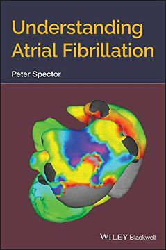 portada Understanding Atrial Fibrillation (en Inglés)