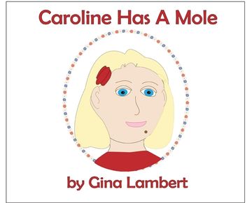 portada Caroline Has A Mole (en Inglés)