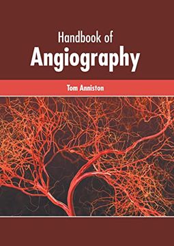 portada Handbook of Angiography (en Inglés)