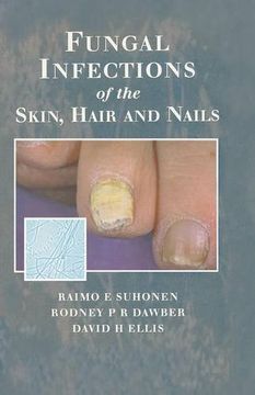 portada Fungal Infections of the Skin and Nails (in English)