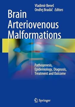 portada Brain Arteriovenous Malformations: Pathogenesis, Epidemiology, Diagnosis, Treatment and Outcome