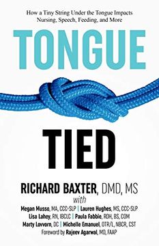 portada Tongue-Tied: How a Tiny String Under the Tongue Impacts Nursing, Speech, Feeding, and More (in English)