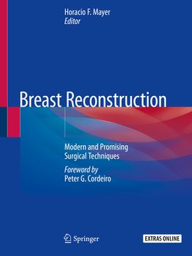 portada Breast Reconstruction: Modern and Promising Surgical Techniques (in English)