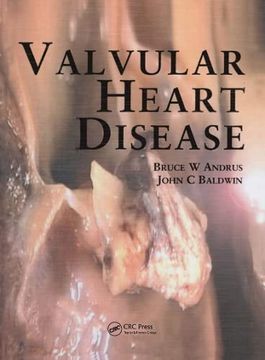 portada Valvular Heart Disease (en Inglés)