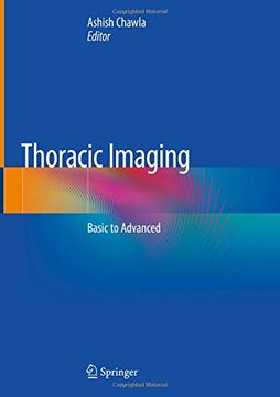 portada Thoracic Imaging: Basic to Advanced (en Inglés)