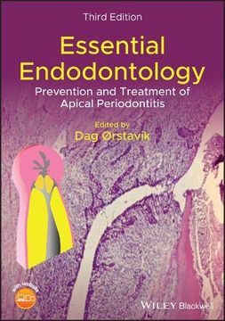 portada Essential Endodontology: Prevention and Treatment of Apical Periodontitis (en Inglés)