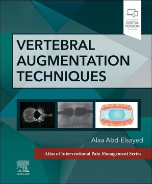 portada Vertebral Augmentation Techniques (Atlas of Interventional Pain Management) (en Inglés)