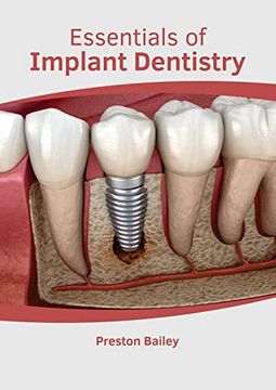 portada Essentials of Implant Dentistry (in English)