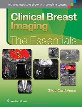 portada Clinical Breast Imaging: The Essentials (in English)