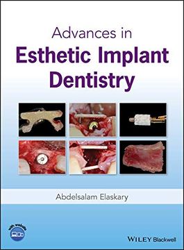 portada Advances in Esthetic Implant Dentistry