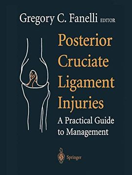 portada Posterior Cruciate Ligament Injuries: A Practical Guide to Management (en Inglés)