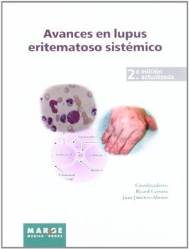 portada Avances en Lupus Eritematoso Sistémico (in Spanish)
