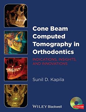 portada Cone Beam Computed Tomography in Orthodontics: Indications, Insights, and Innovations (en Inglés)