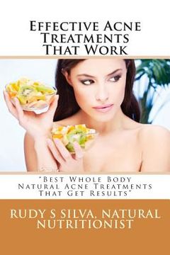 portada Effective Acne Treatments That Work: "Best Whole Body Natural Acne Treatments That Get Results" (in English)