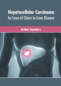 portada Hepatocellular Carcinoma: An Issue of Clinics in Liver Disease (en Inglés)
