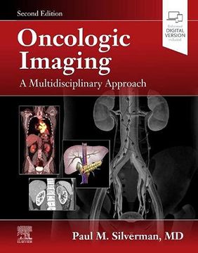 portada Oncologic Imaging: A Multidisciplinary Approach: Expert Consult - Online and Print (en Inglés)
