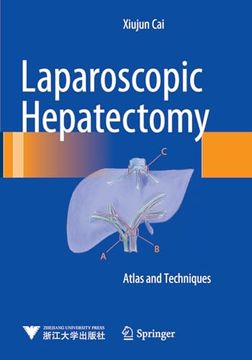portada Laparoscopic Hepatectomy: Atlas and Techniques (in English)