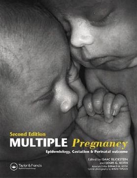 portada Multiple Pregnancy: Epidemiology, Gestation, and Perinatal Outcome (en Inglés)