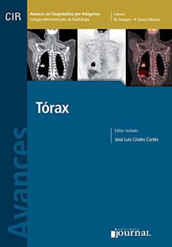 portada Torax - Avances En Diagnostico Por Imagenes