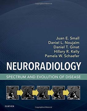 portada Neuroradiology: Spectrum and Evolution of Disease (in English)