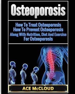 portada Osteoporosis: How To Treat Osteoporosis: How To Prevent Osteoporosis: Along With Nutrition, Diet And Exercise For Osteoporosis