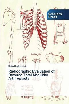 portada Radiographic Evaluation of Reverse Total Shoulder Arthroplasty