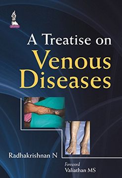 portada A Treatise on Venous Diseases