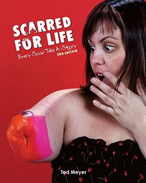 portada Scarred for Life. 2nd Edition: Every Scar Tells a Story (en Inglés)