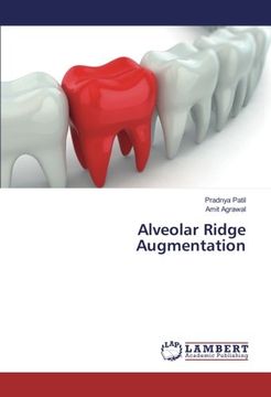 portada Alveolar Ridge Augmentation