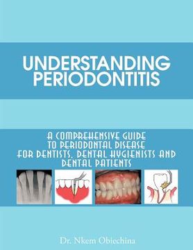 portada understanding periodontitis: a comprehensive guide to periodontal disease for dentists, dental hygienists and dental patients (en Inglés)