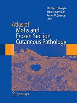 portada Atlas of Mohs and Frozen Section Cutaneous Pathology (en Inglés)