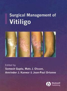 portada Surgical Management of Vitiligo (en Inglés)