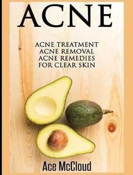 portada Acne: Acne Treatment: Acne Removal: Acne Remedies For Clear Skin (Acne Skin Care Treatments From Diet & Medical)