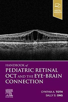 portada Handbook of Pediatric Retinal oct the Eye-Brain Connection (en Inglés)