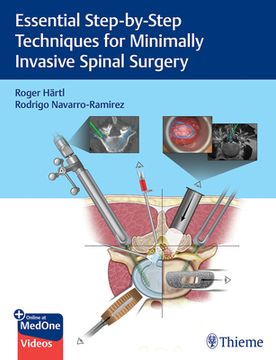 portada Essential Step-By-Step Techniques for Minimally Invasive Spinal Surgery (en Inglés)